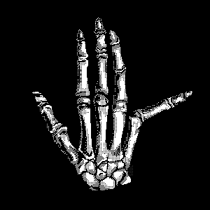 Commission for Joint Pain Band